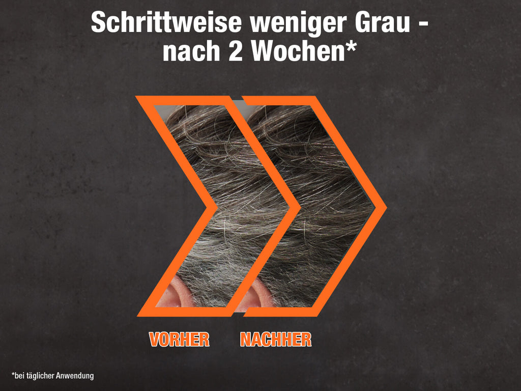 Vorher-Nachher-Darstellung der Haarveränderung durch Alpecin Grey Attack Max. Zwei Bilder eines männlichen Haarschopfs, links mit grauem Haar (‚Vorher‘), rechts mit dunklerem Haar (‚Nachher‘), eingerahmt von orangefarbenen Pfeilen. Darüber steht in weißer Schrift: ‚Schrittweise weniger Grau – nach 2 Wochen‘. Kleine Fußnote unten links: ‚bei täglicher Anwendung‘.